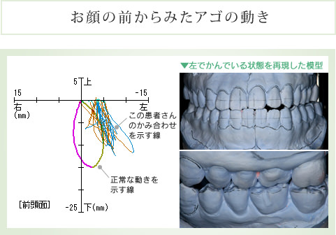 お顔の前からみたアゴの動き